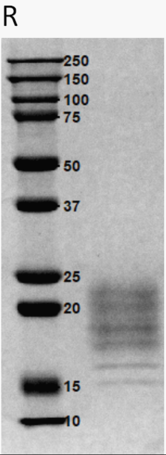 2、SDS-PAGE.jpg